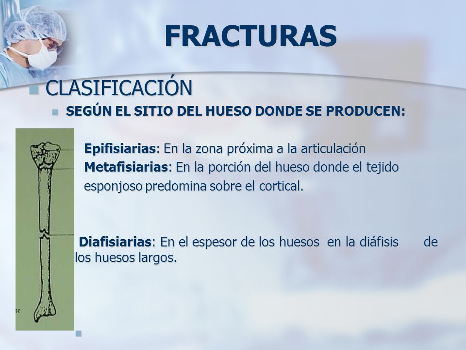 FRACTURAS CLASIFICACIÓN SEGÚN EL SITIO DEL HUESO DONDE SE PRODUCEN: