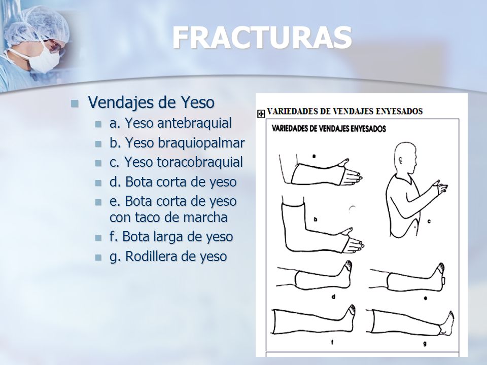 FRACTURAS Vendajes de Yeso a. Yeso antebraquial b. Yeso braquiopalmar
