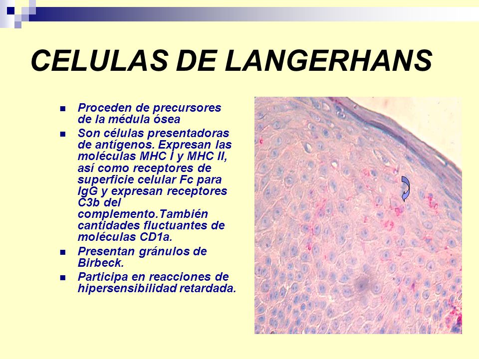 CELULAS DE LANGERHANS Proceden de precursores de la médula ósea