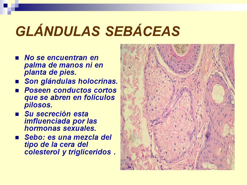 GLÁNDULAS SEBÁCEAS No se encuentran en palma de manos ni en planta de pies. Son glándulas holocrinas.