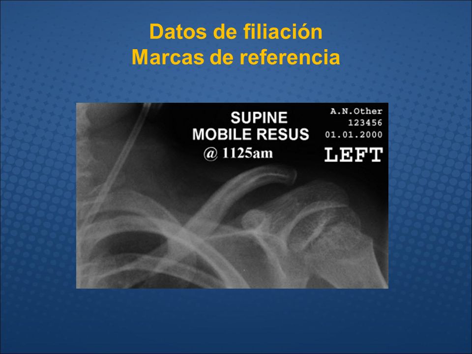 Datos de filiación Marcas de referencia