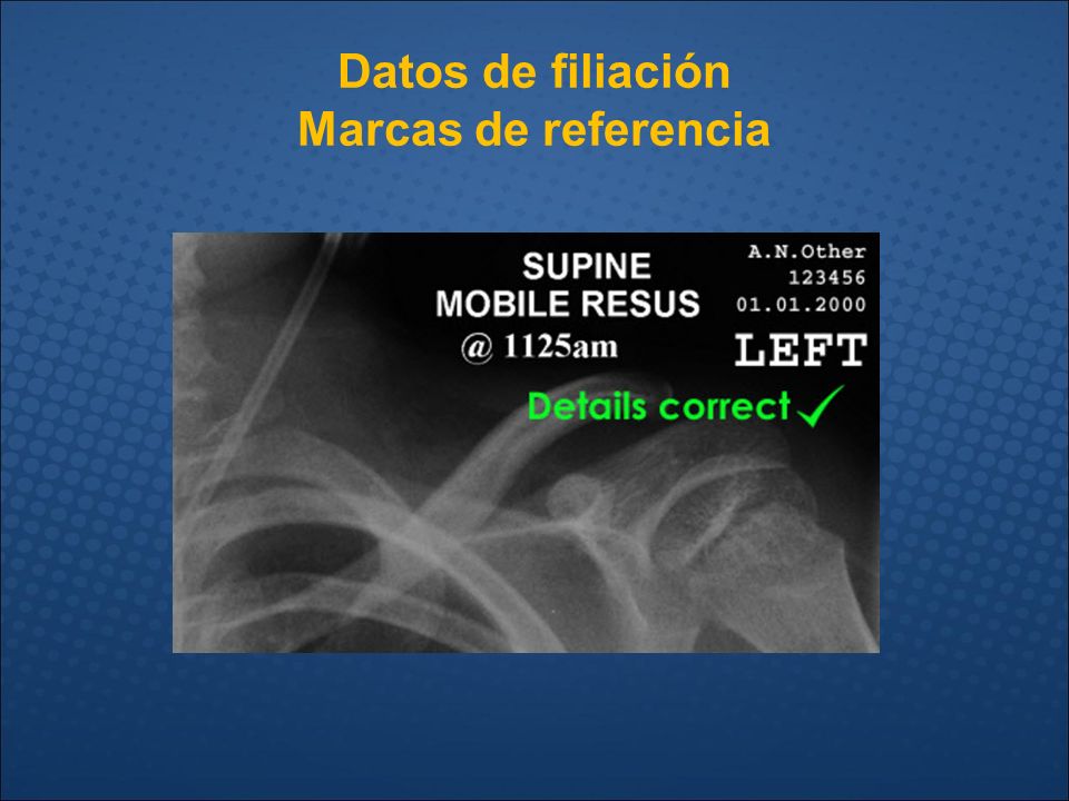 Datos de filiación Marcas de referencia
