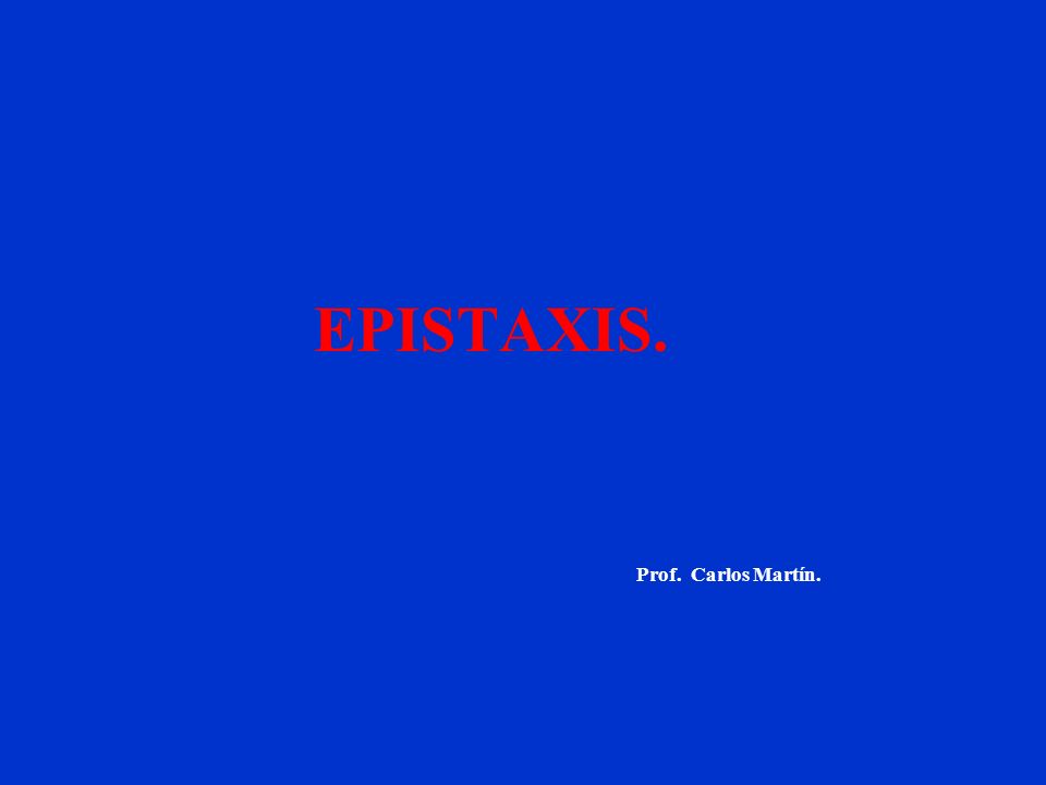 EPISTAXIS. Prof. Carlos Martín.