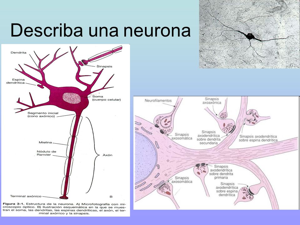 Describa una neurona