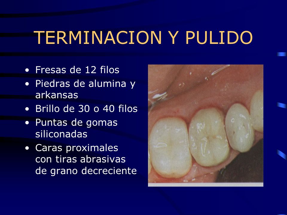 TERMINACION Y PULIDO Fresas de 12 filos Piedras de alumina y arkansas
