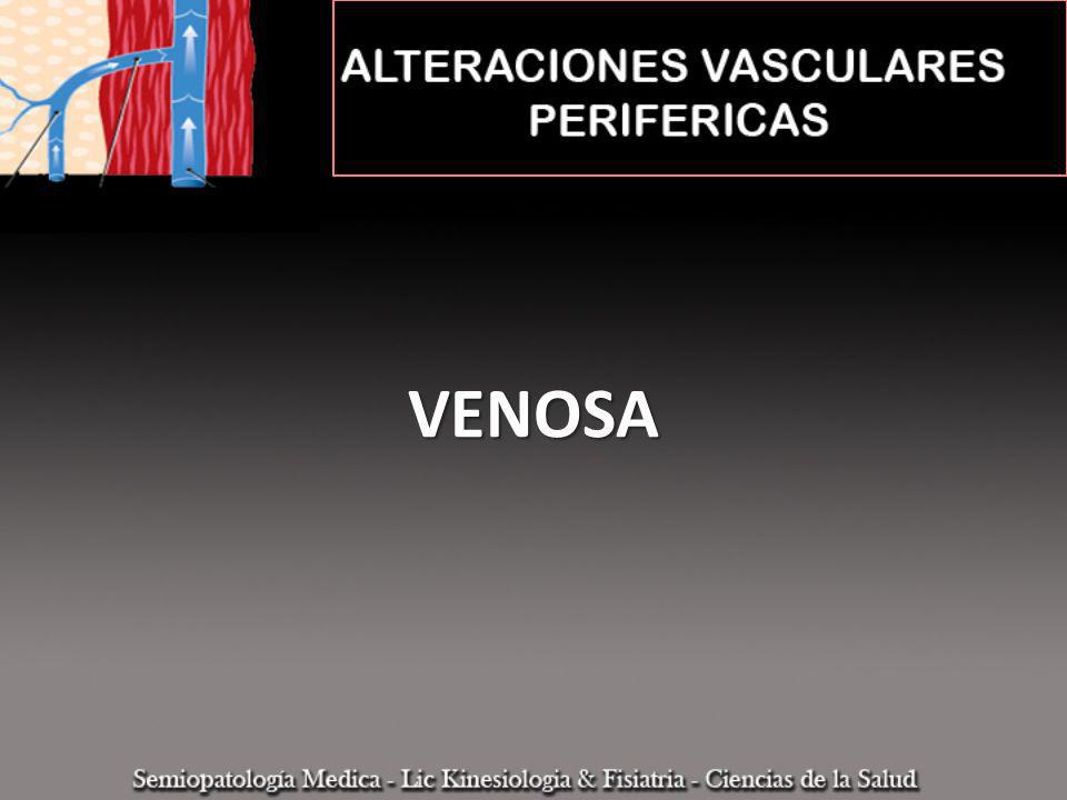 VENOSA