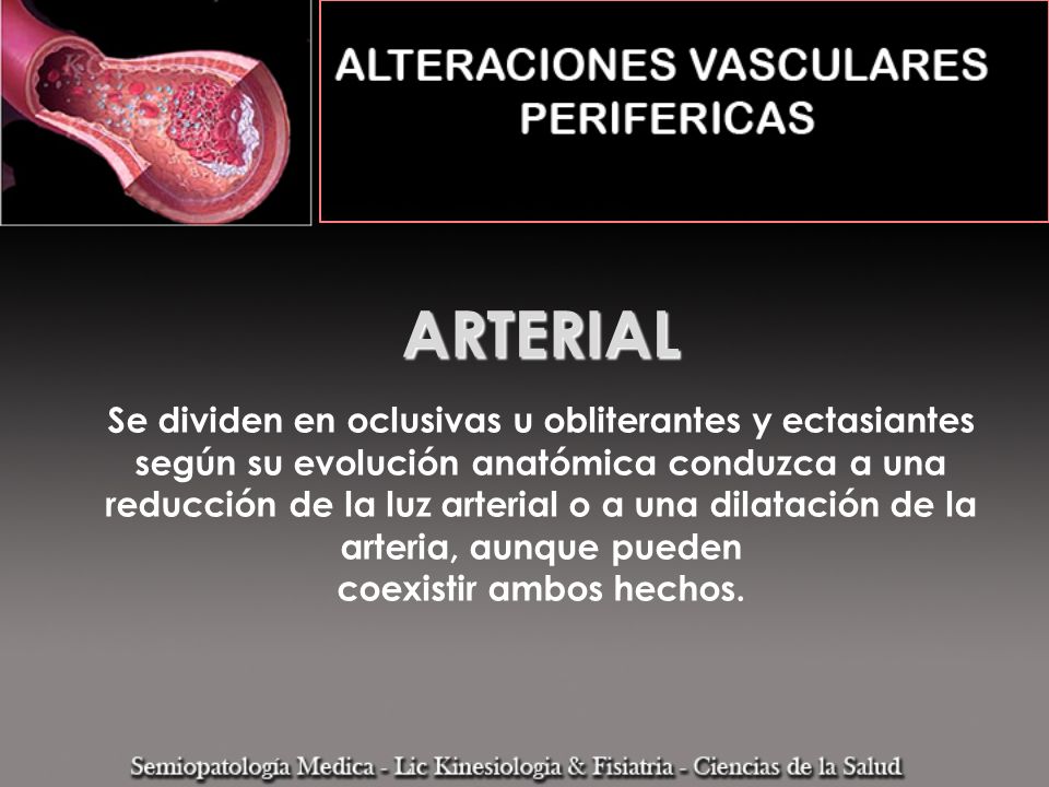ARTERIAL Se dividen en oclusivas u obliterantes y ectasiantes según su evolución anatómica conduzca a una reducción de la luz arterial o a una dilatación de la arteria, aunque pueden coexistir ambos hechos.