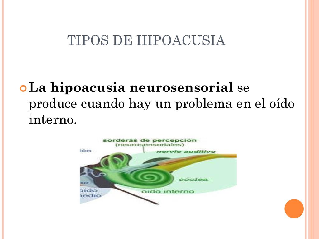 TIPOS DE HIPOACUSIA La hipoacusia neurosensorial se produce cuando hay un problema en el oído interno.