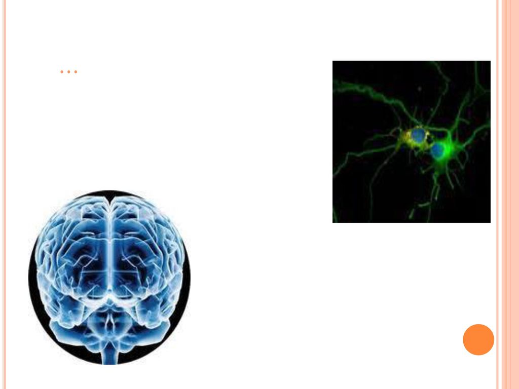 … A medida que las células nerviosas (neuronas) mueren y diferentes zonas del cerebro se atrofian.