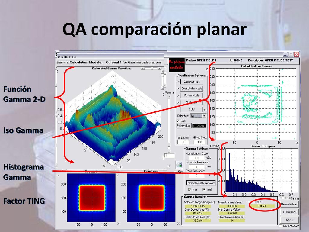 QA comparación planar Función Gamma 2-D Iso Gamma Histograma Gamma