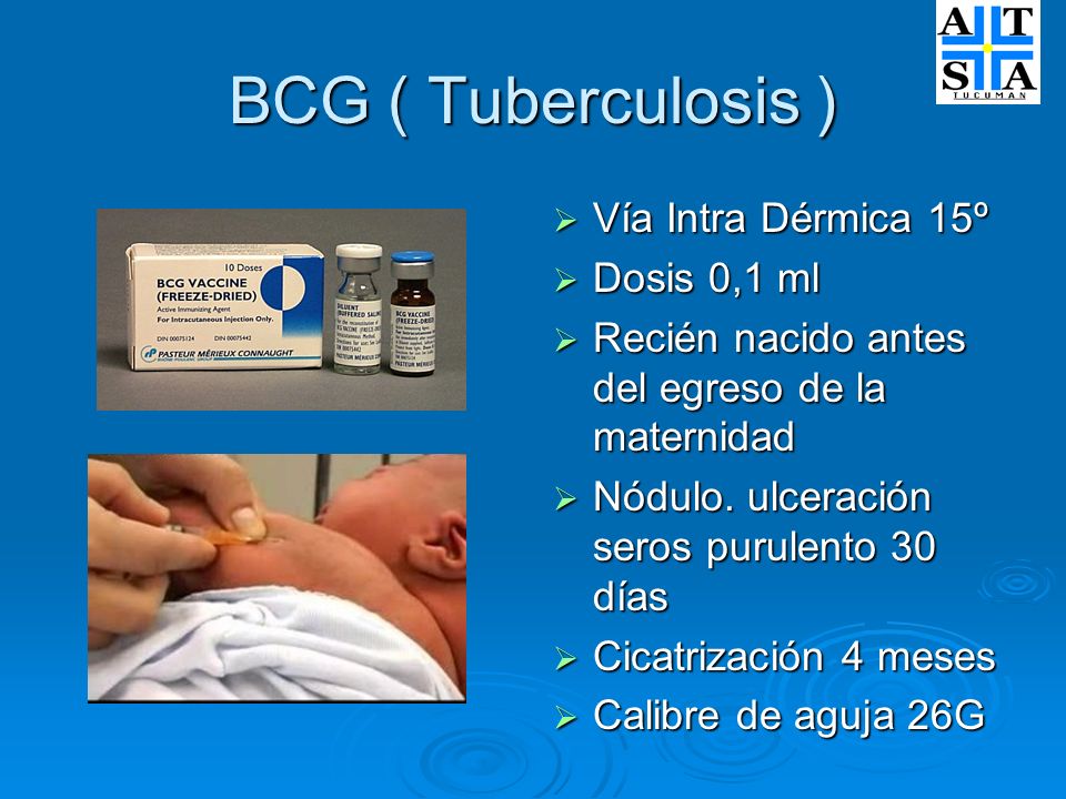 BCG ( Tuberculosis ) Vía Intra Dérmica 15º Dosis 0,1 ml