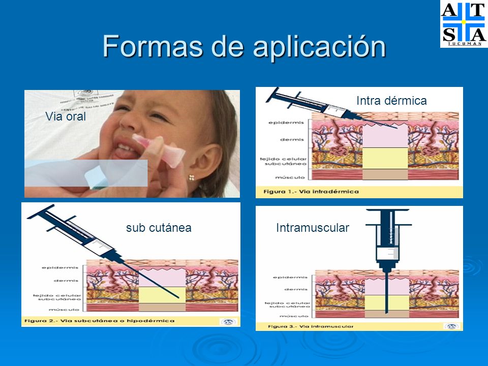 Formas de aplicación Intra dérmica Via oral sub cutánea Intramuscular