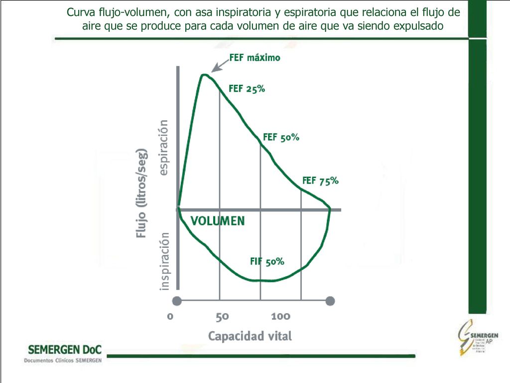 Curva flujo-volumen, con asa inspiratoria y espiratoria que relaciona el flujo de aire que se produce para cada volumen de aire que va siendo expulsado