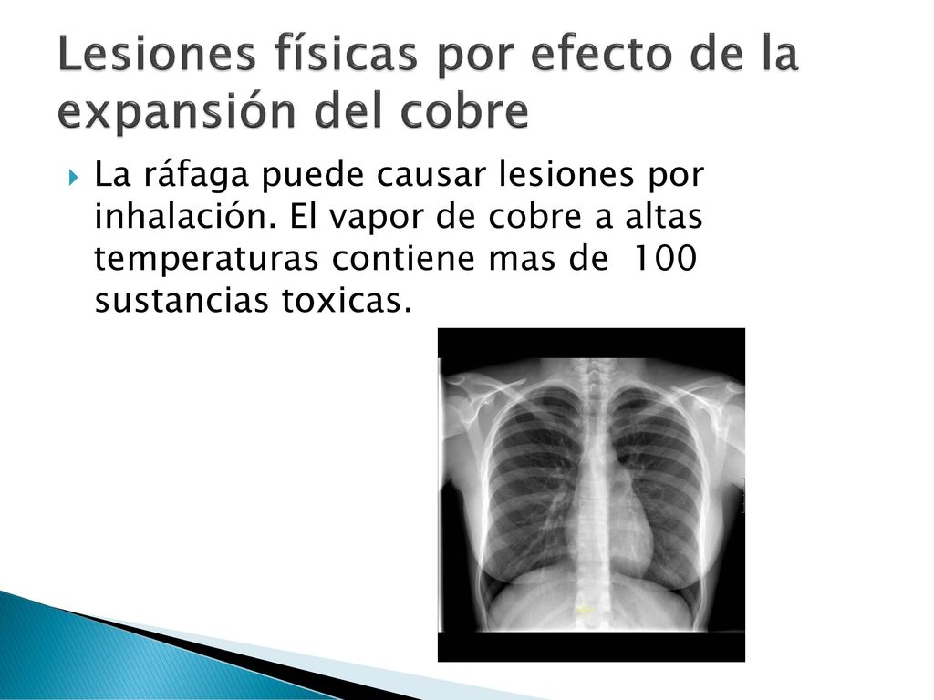 Lesiones físicas por efecto de la expansión del cobre