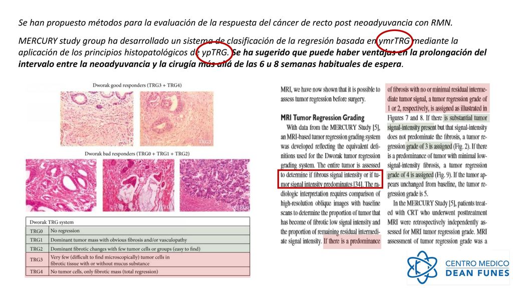 Se han propuesto métodos para la evaluación de la respuesta del cáncer de recto post neoadyuvancia con RMN.