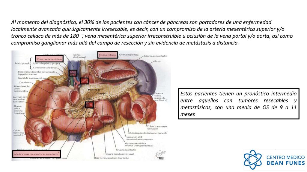 Al momento del diagnóstico, el 30% de los pacientes con cáncer de páncreas son portadores de una enfermedad localmente avanzada quirúrgicamente irresecable, es decir, con un compromiso de la arteria mesentérica superior y/o tronco celíaco de más de 180 °, vena mesentérica superior irreconstruible u oclusión de la vena portal y/o aorta, así como compromiso ganglionar más allá del campo de resección y sin evidencia de metástasis a distancia.