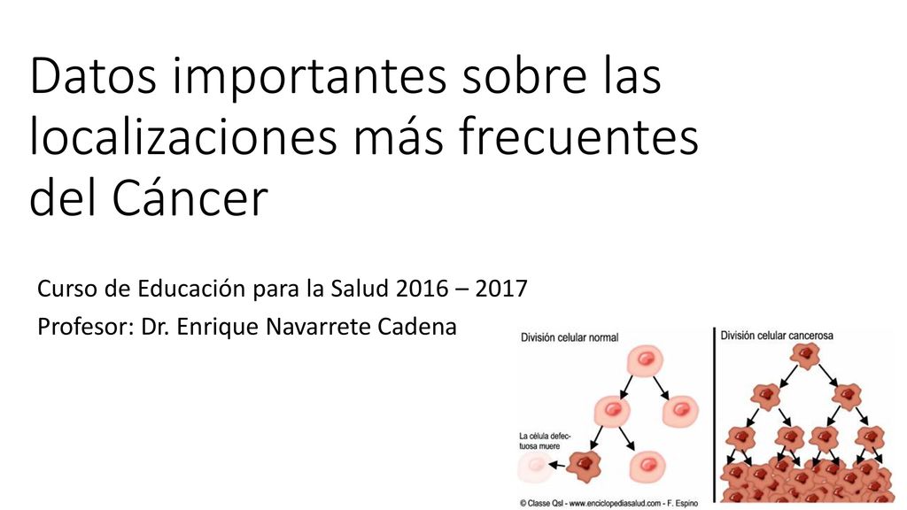 Datos importantes sobre las localizaciones más frecuentes del Cáncer