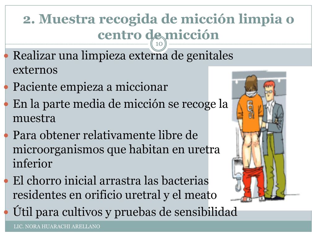 2. Muestra recogida de micción limpia o centro de micción