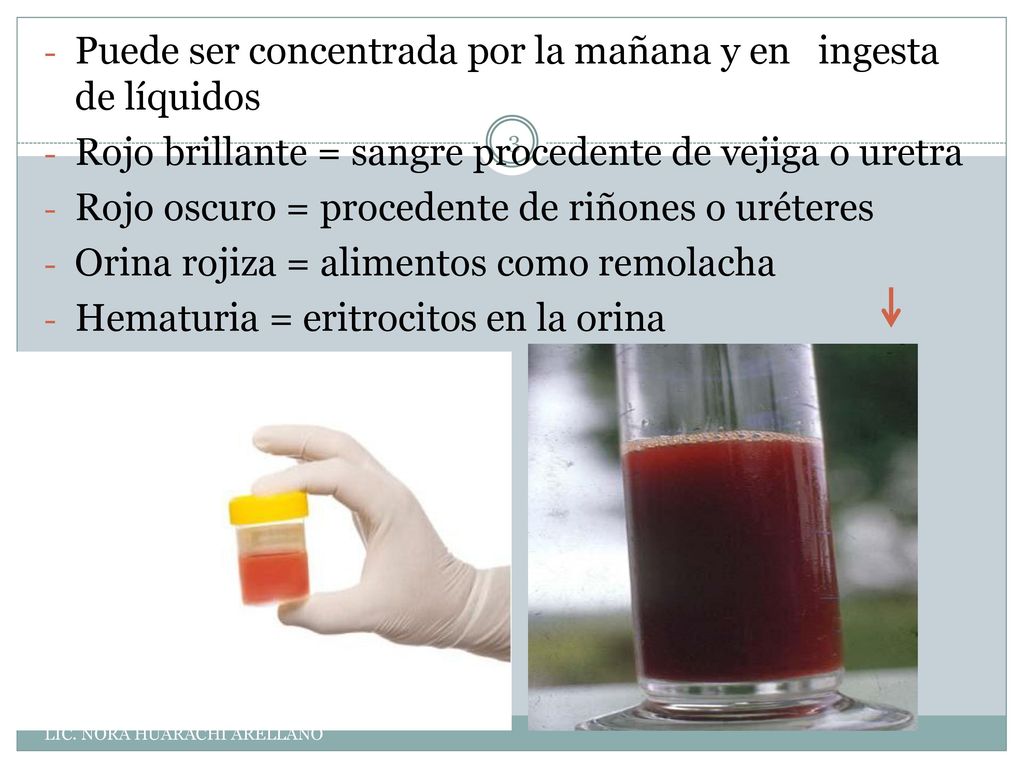 Puede ser concentrada por la mañana y en ingesta de líquidos