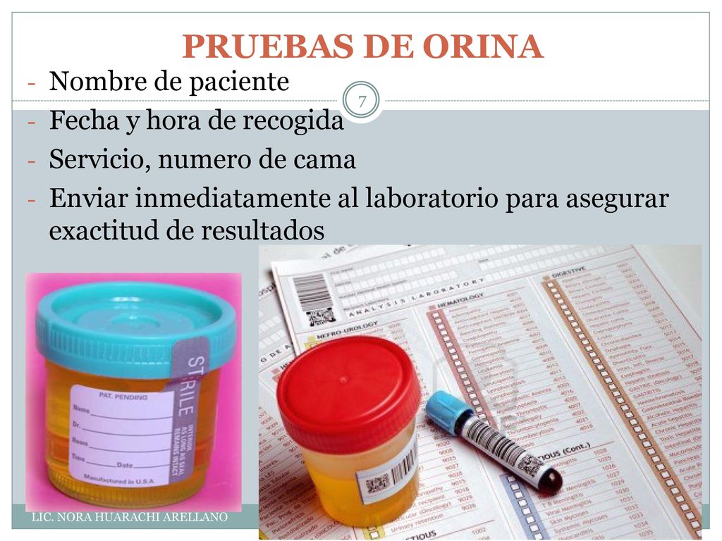 PRUEBAS DE ORINA Nombre de paciente Fecha y hora de recogida
