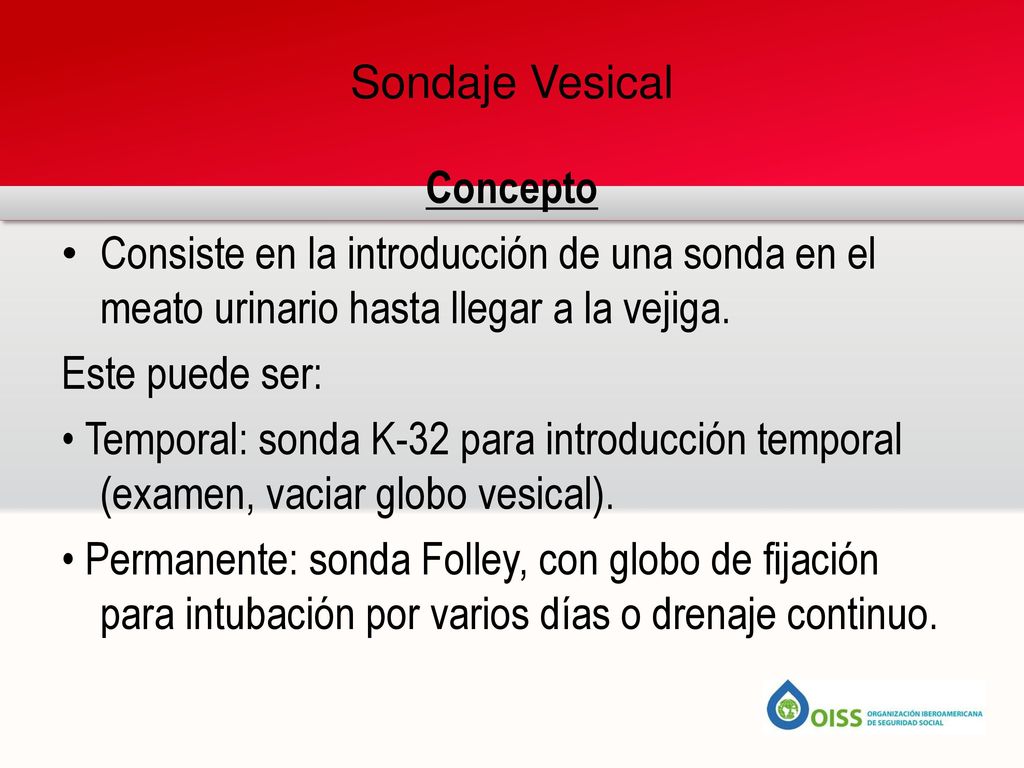 Sondaje Vesical Concepto. Consiste en la introducción de una sonda en el meato urinario hasta llegar a la vejiga.