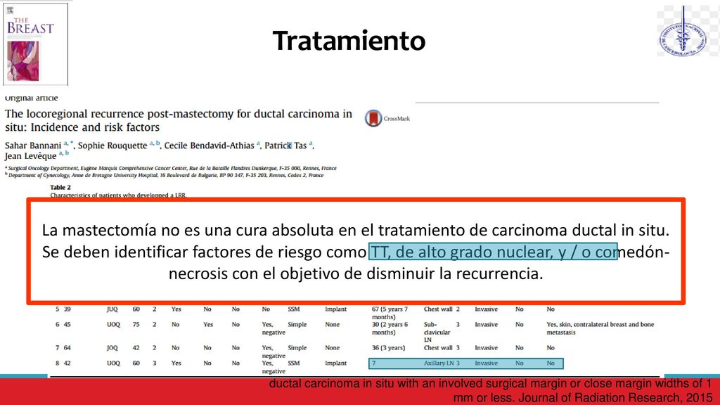 Tratamiento La mastectomía no es una cura absoluta en el tratamiento de carcinoma ductal in situ.