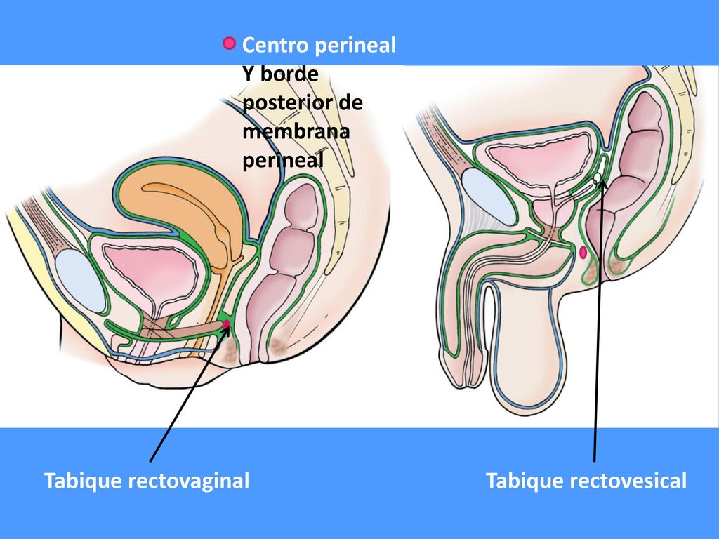 Centro perineal Y borde posterior de membrana perineal Tabique rectovaginal Tabique rectovesical