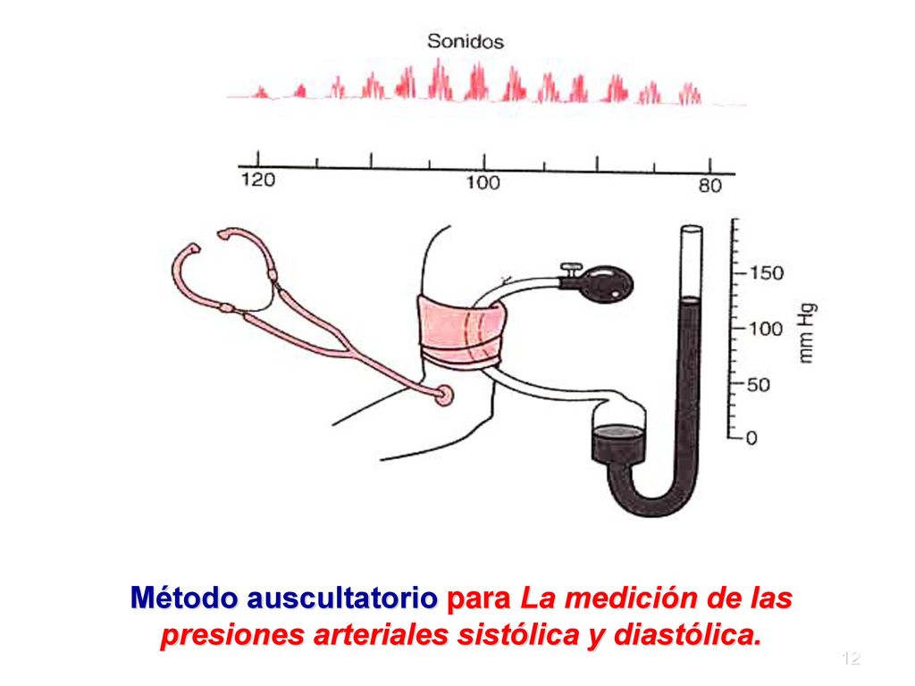 Método auscultatorio para La medición de las presiones arteriales sistólica y diastólica.