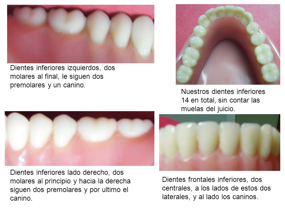 Dientes inferiores izquierdos, dos molares al final, le siguen dos premolares y un canino.