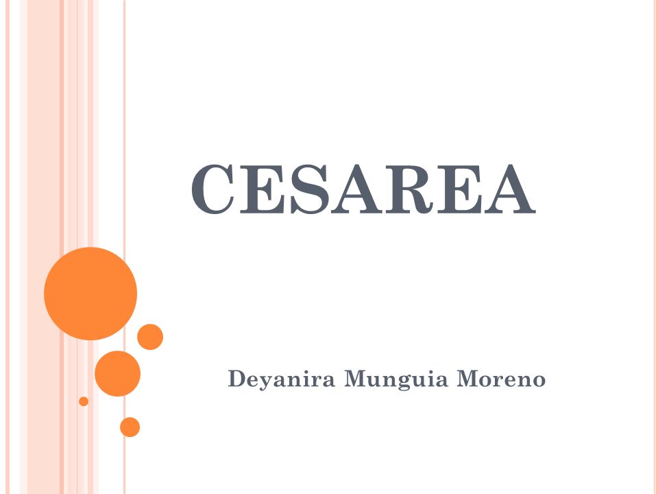 Deyanira Munguia Moreno