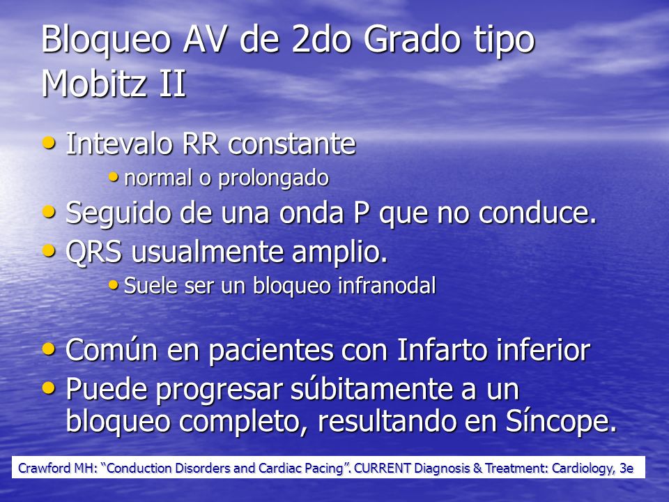 Bloqueo AV de 2do Grado tipo Mobitz II