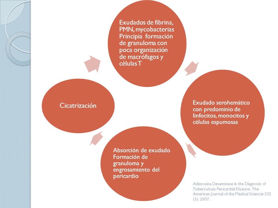 Exudados de fibrina, PMN, mycobacterias Principia formación de granuloma con poca organización de macrófagos y células T