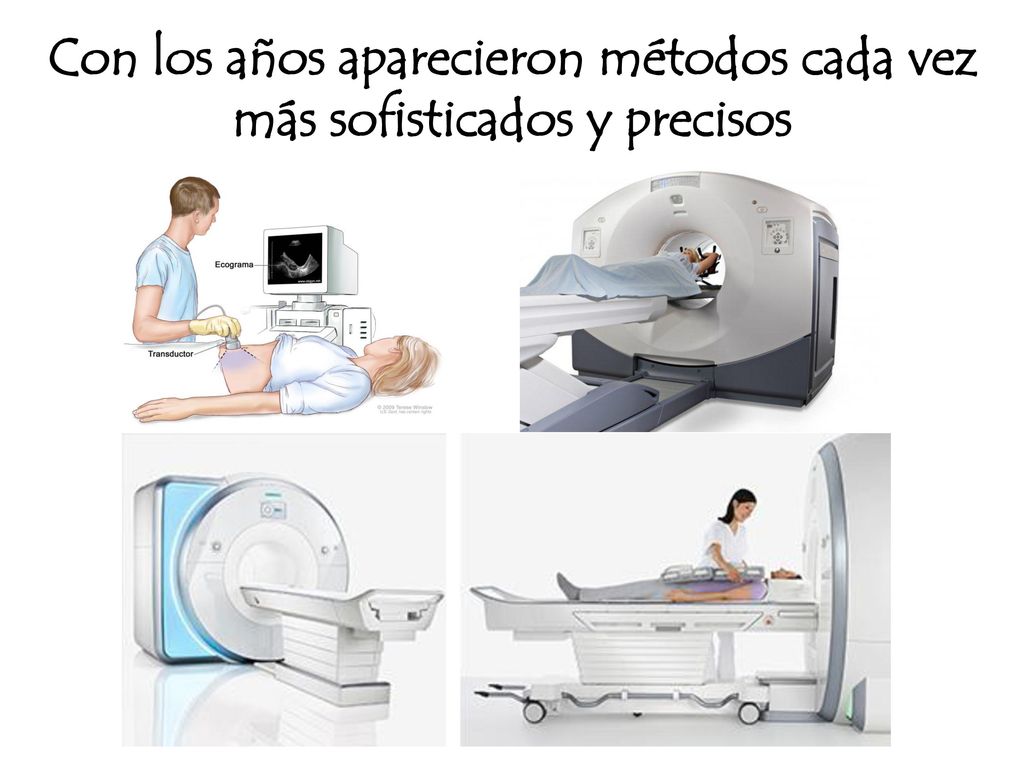 Con los años aparecieron métodos cada vez más sofisticados y precisos