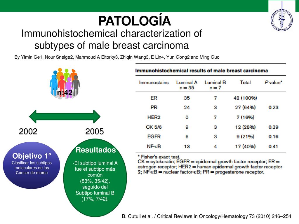 PATOLOGÍA Immunohistochemical characterization of subtypes of male breast carcinoma.