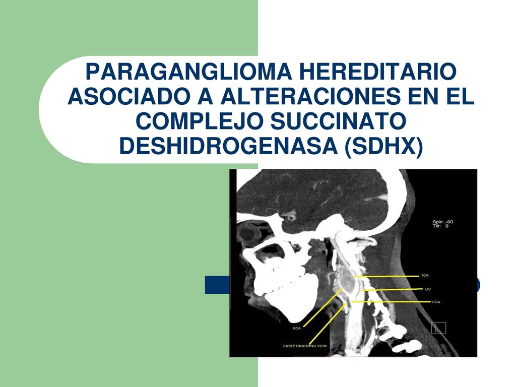 PARAGANGLIOMA HEREDITARIO ASOCIADO A ALTERACIONES EN EL COMPLEJO SUCCINATO DESHIDROGENASA (SDHX)