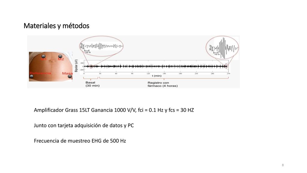 Materiales y métodos Amplificador Grass 15LT Ganancia 1000 V/V, fci = 0.1 Hz y fcs = 30 HZ. Junto con tarjeta adquisición de datos y PC.
