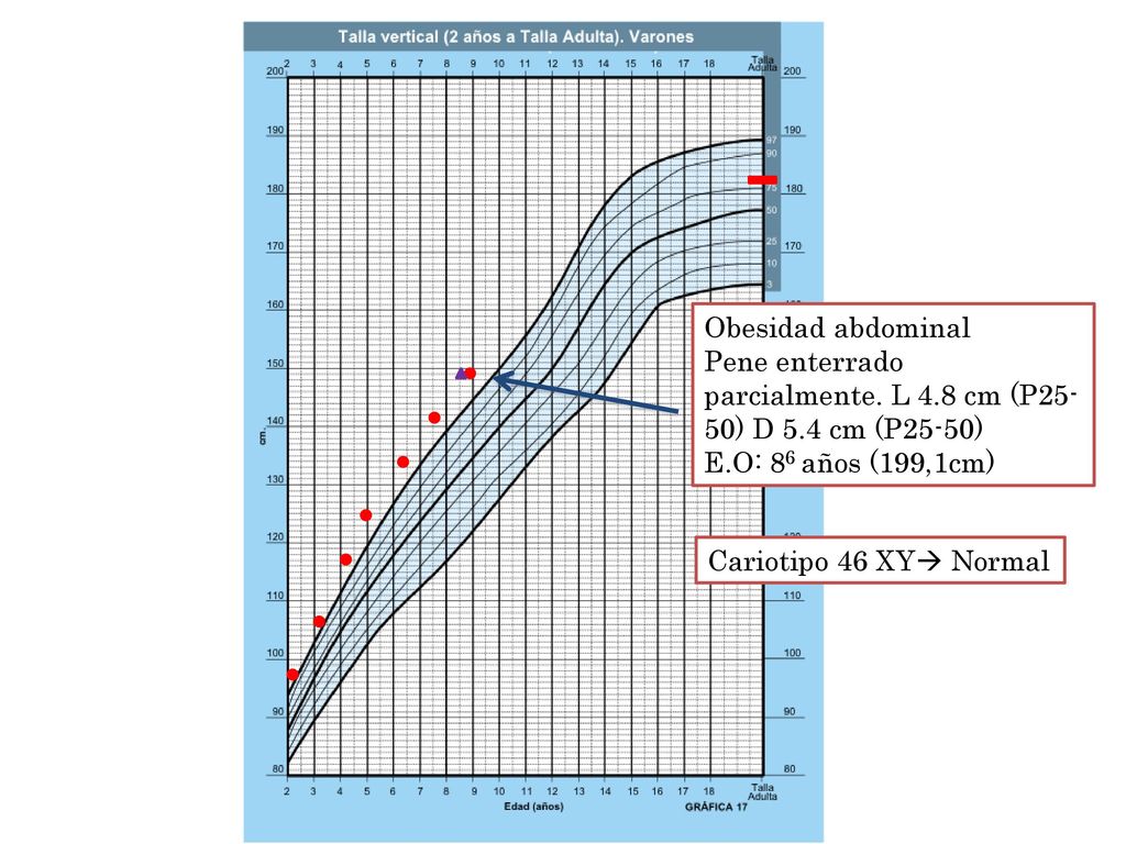 Obesidad abdominal Pene enterrado parcialmente. L 4.8 cm (P25-50) D 5.4 cm (P25-50) E.O: 86 años (199,1cm)
