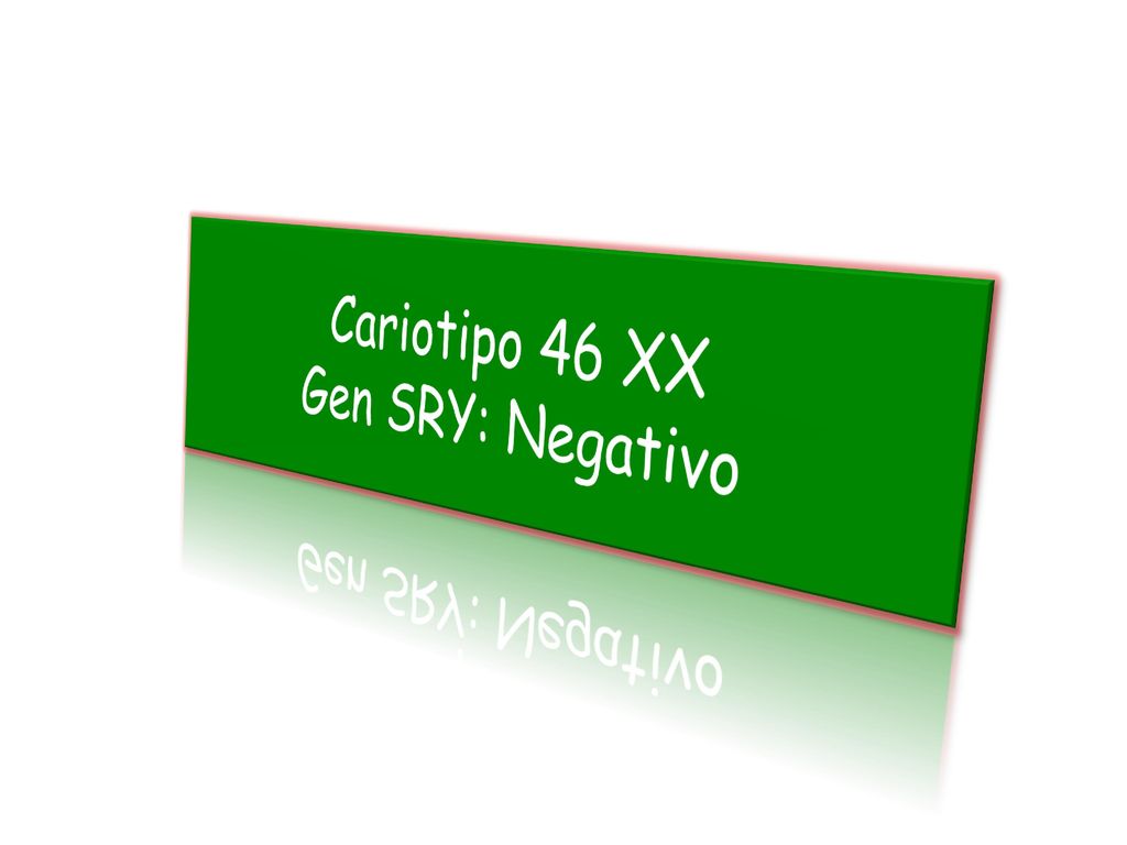 Cariotipo 46 XX Gen SRY: Negativo