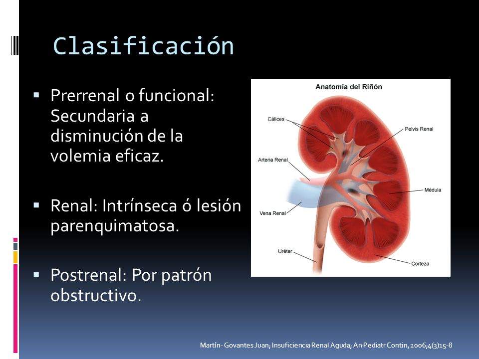 Clasificación Prerrenal o funcional: Secundaria a disminución de la volemia eficaz. Renal: Intrínseca ó lesión parenquimatosa.