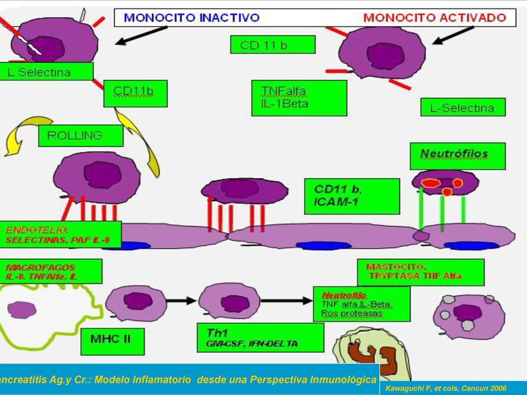 Pancreatitis Ag.y Cr.: Modelo Inflamatorio desde una Perspectiva Inmunológica