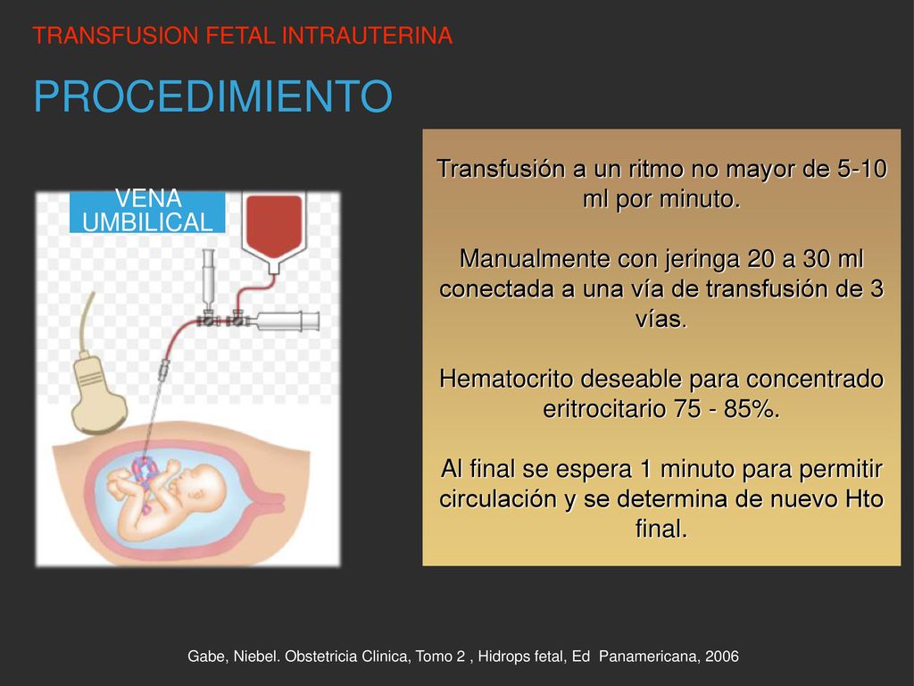 PROCEDIMIENTO Transfusión a un ritmo no mayor de 5-10 ml por minuto.