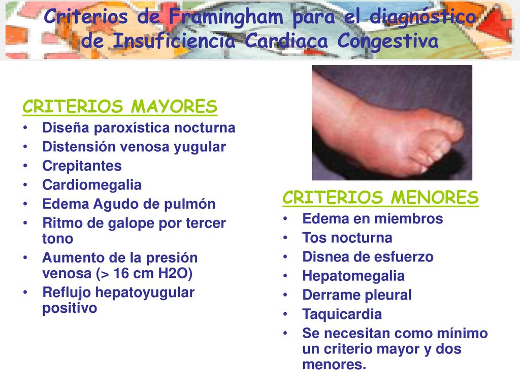 Criterios de Framingham para el diagnóstico de Insuficiencia Cardiaca Congestiva