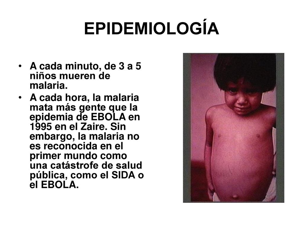 EPIDEMIOLOGÍA A cada minuto, de 3 a 5 niños mueren de malaria.