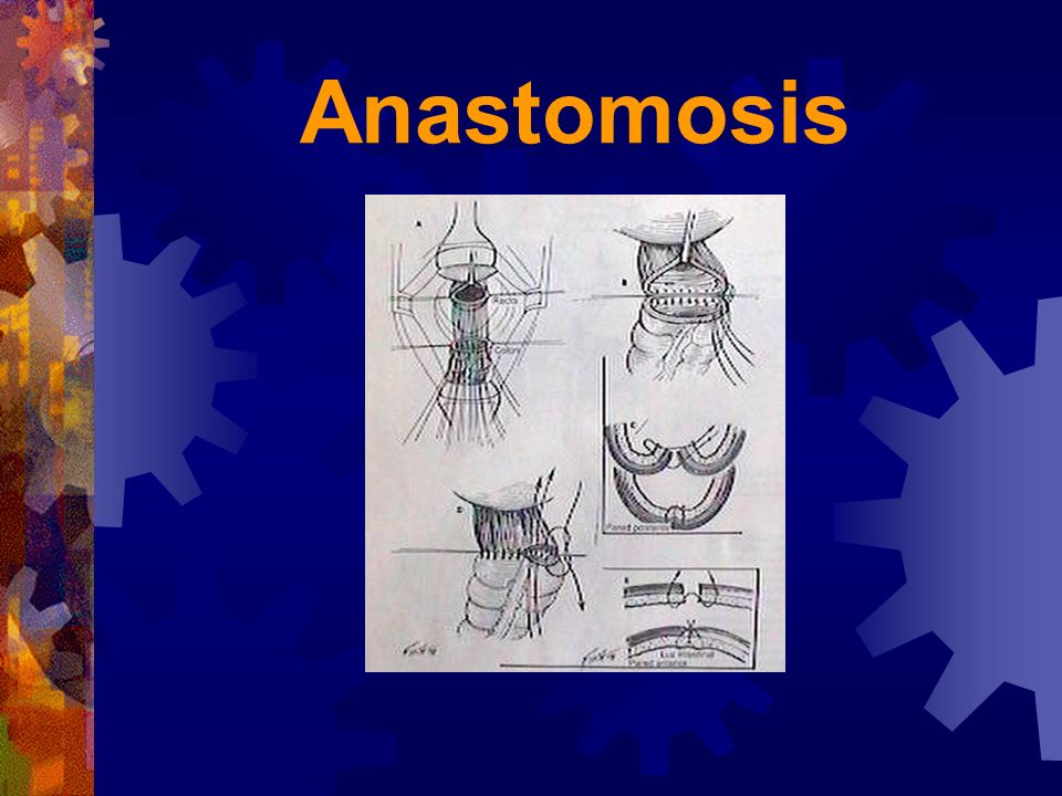Anastomosis