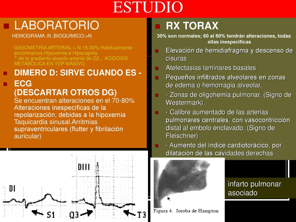 ESTUDIO LABORATORIO RX TORAX DIMERO D: SIRVE CUANDO ES -