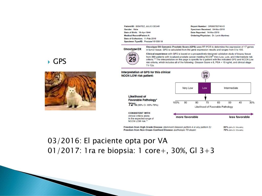 GPS 03/2016: El paciente opta por VA 01/2017: 1ra re biopsia: 1 core+, 30%, Gl 3+3