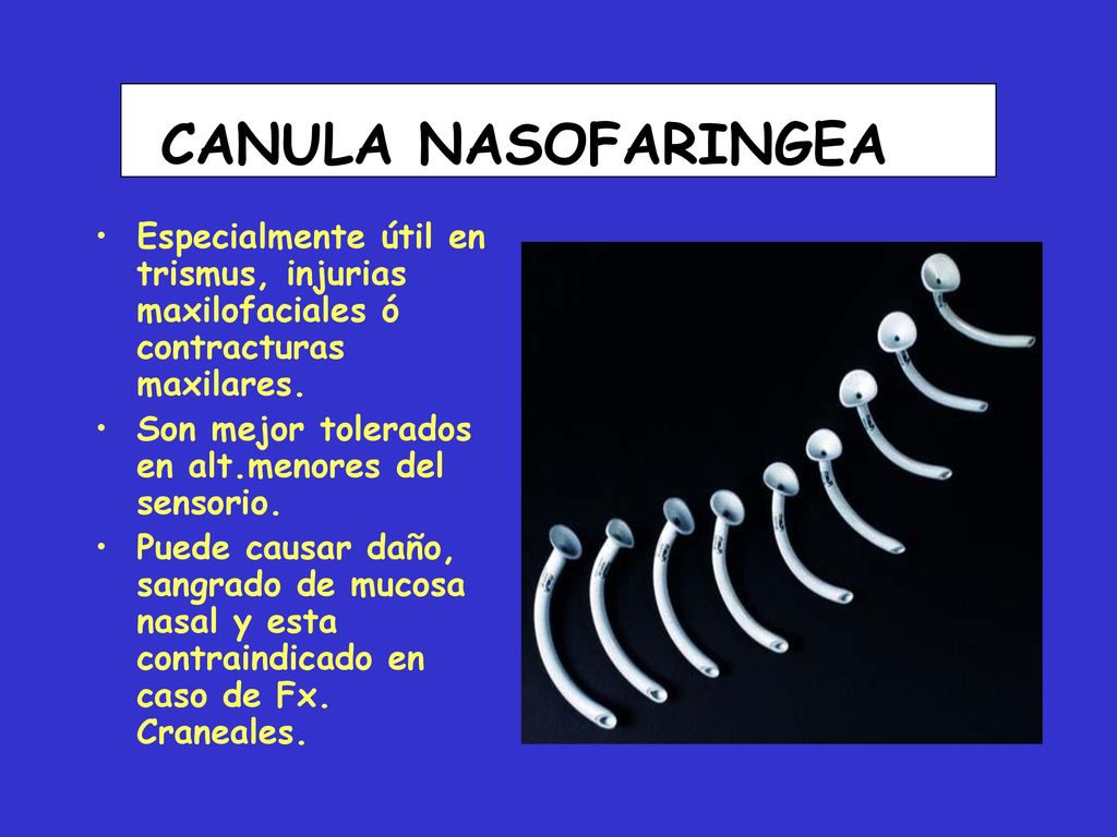 CANULA NASOFARINGEA Especialmente útil en trismus, injurias maxilofaciales ó contracturas maxilares.