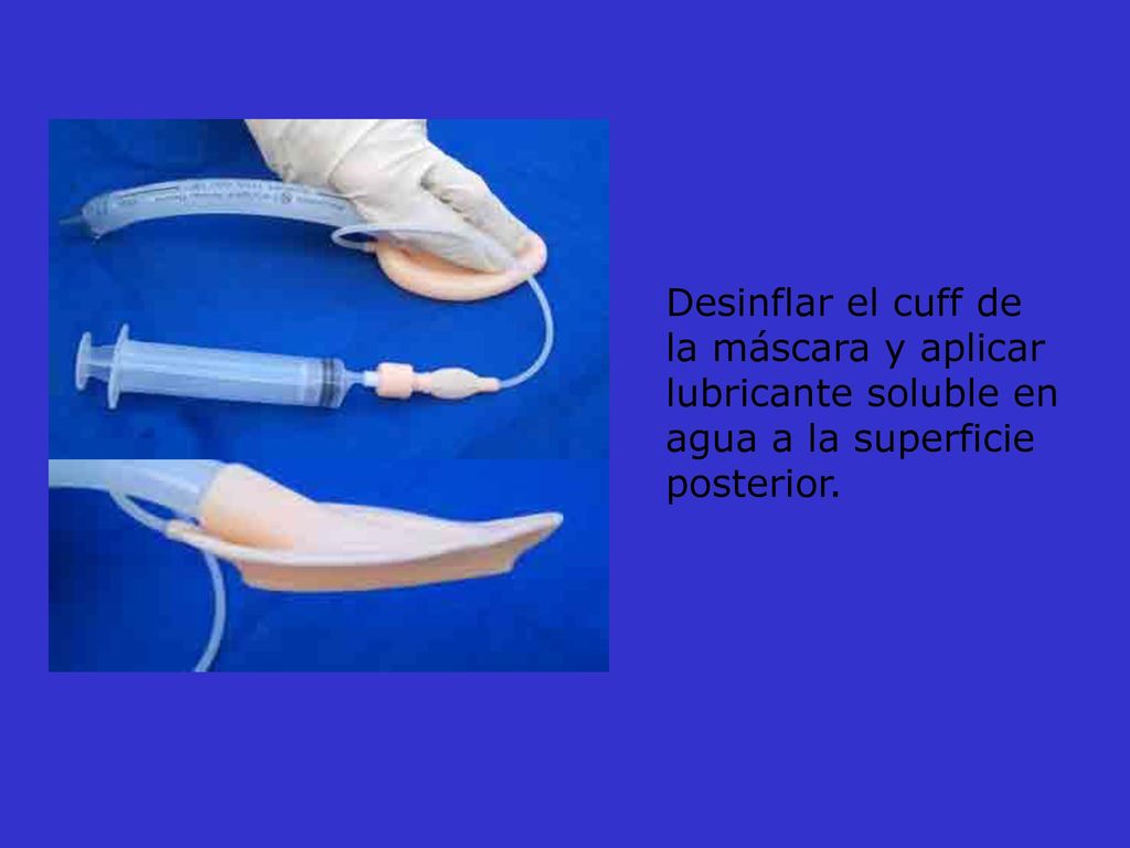 Desinflar el cuff de la máscara y aplicar lubricante soluble en agua a la superficie posterior.