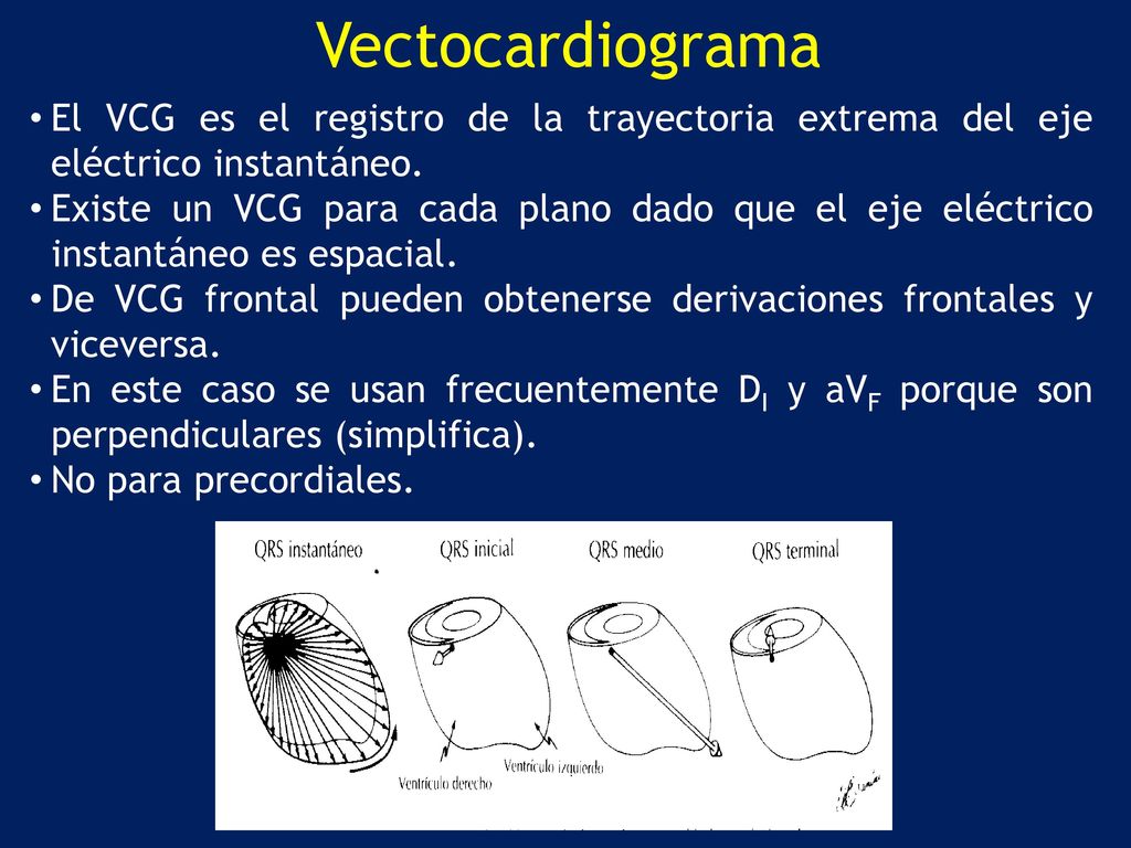 Vectocardiograma El VCG es el registro de la trayectoria extrema del eje eléctrico instantáneo.