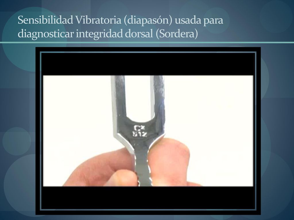Sensibilidad Vibratoria (diapasón) usada para diagnosticar integridad dorsal (Sordera)